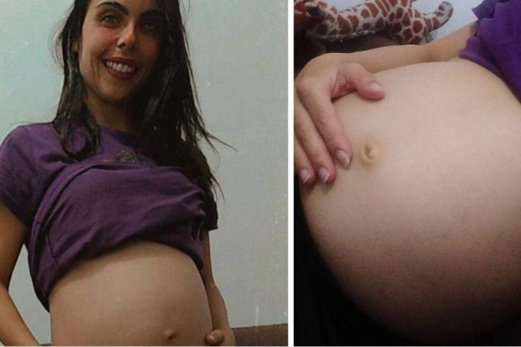 Ultrassom de quíntuplos