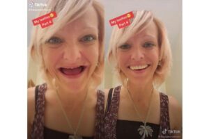 Jessica tem planos de colocar o implante dentário