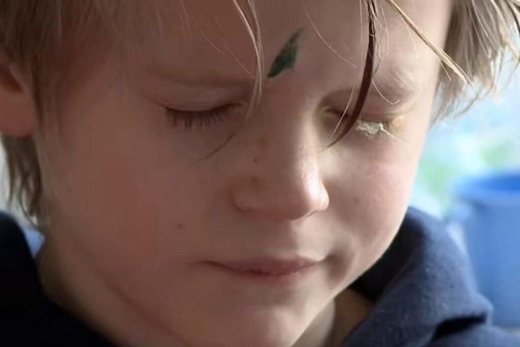 Kevin confundiu os frascos e acabou colando os cílios do filho de 9 anos com supercola