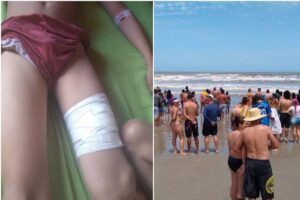 Menino é ferido por tubarão