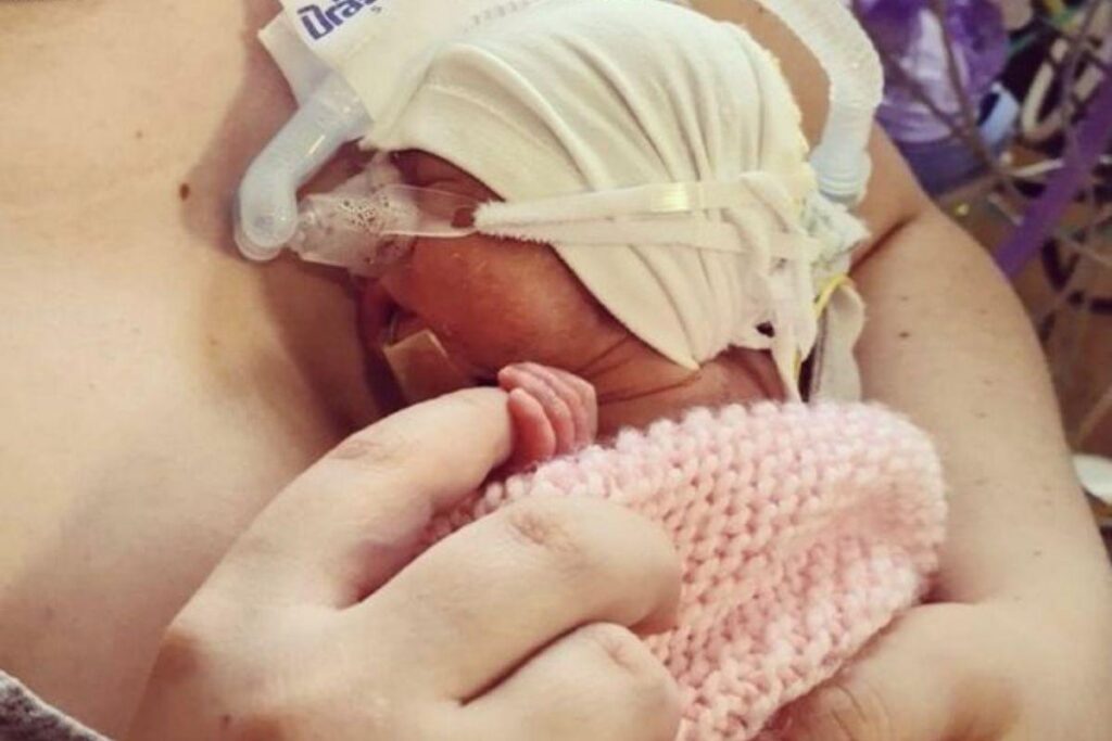 A direita Ayla no hospital e a esquerda Jasmine com a filha após ela receber alta