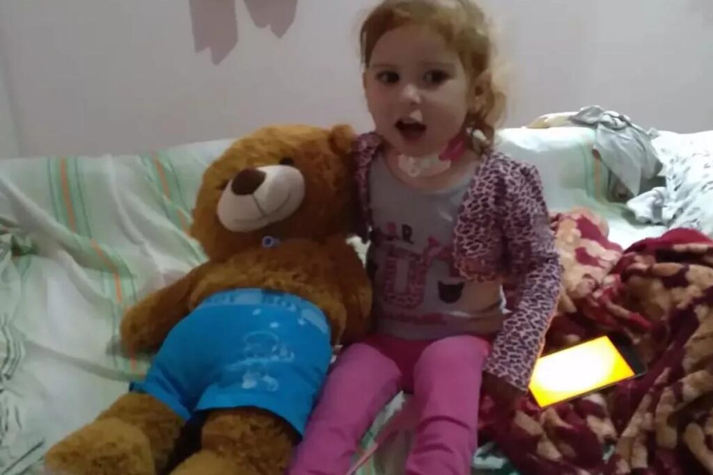 Pérola passou por uma cirurgia por conta da síndrome rara