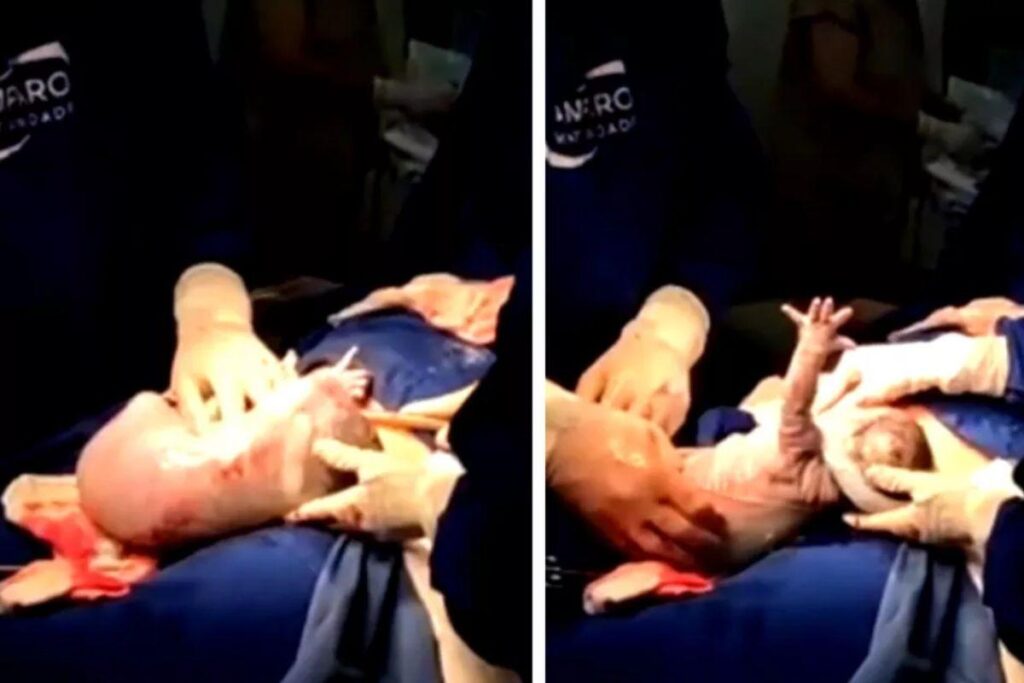 O bebê rompeu sozinho a bolsa amniótica!