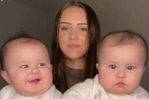 A mãe disse que não usa efeito nos vídeos e que os bebês são assim mesmo