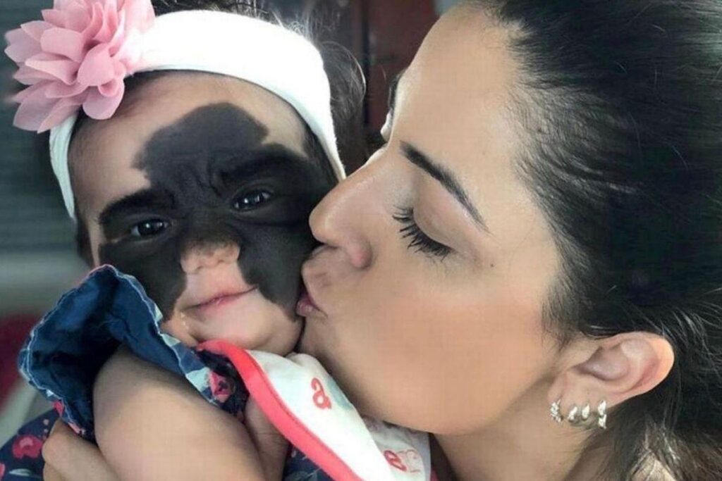 Luna passou por vários procedimentos cirúrgicos