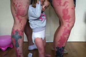 Pais tatuam marca de nascença da filha na perna para que ela se sinta mais bonita