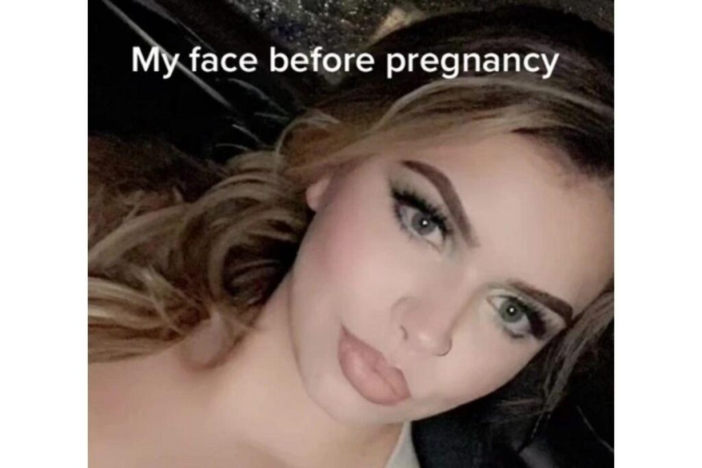 Savanna antes e depois da gestação