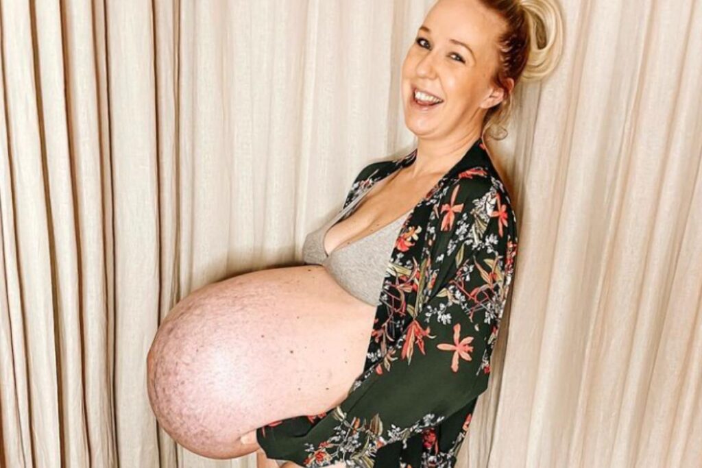 Michella mostrou o corpo 10 dias após o parto