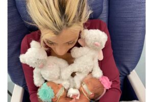 Lilly e Addy nasceram grudadas