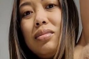 As axilas de Linda ficaram super inchadas!