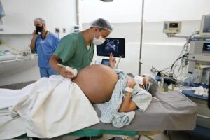 O caso de Yanike é extremamente raro