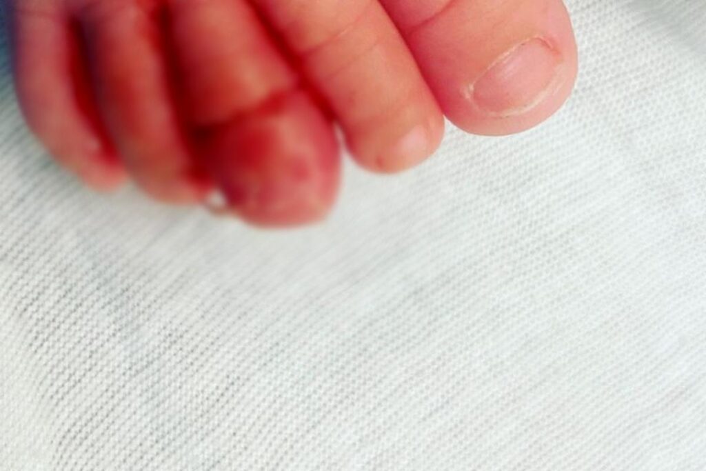 Nikki admitiu que a filha se machucou