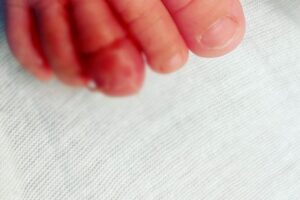 Nikki admitiu que a filha se machucou