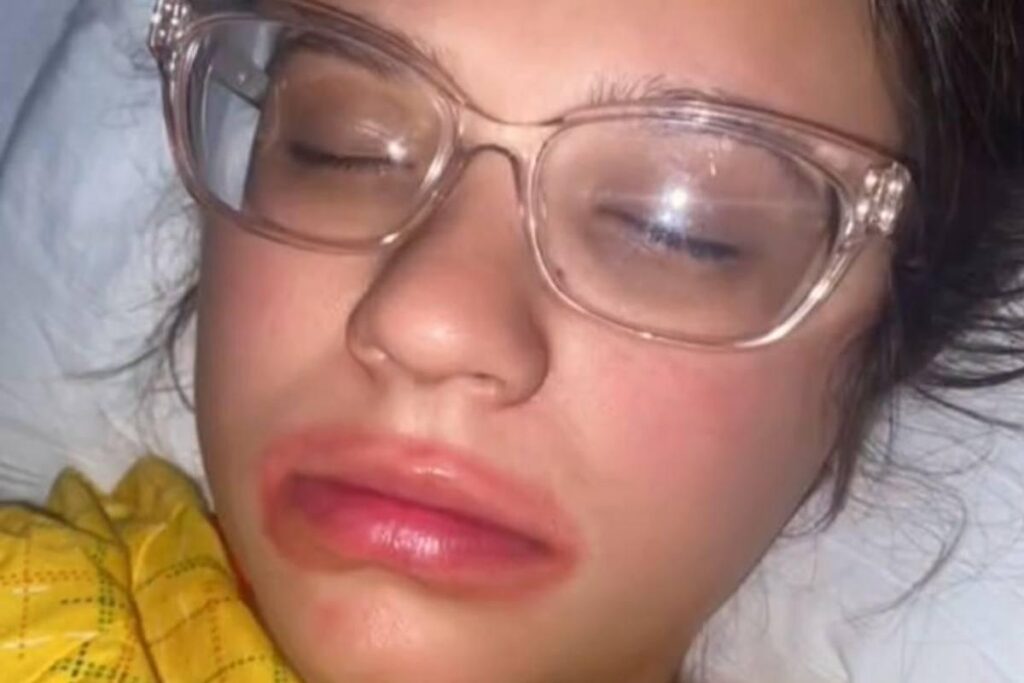 Na verdade era só o gloss vermelho na boca dela