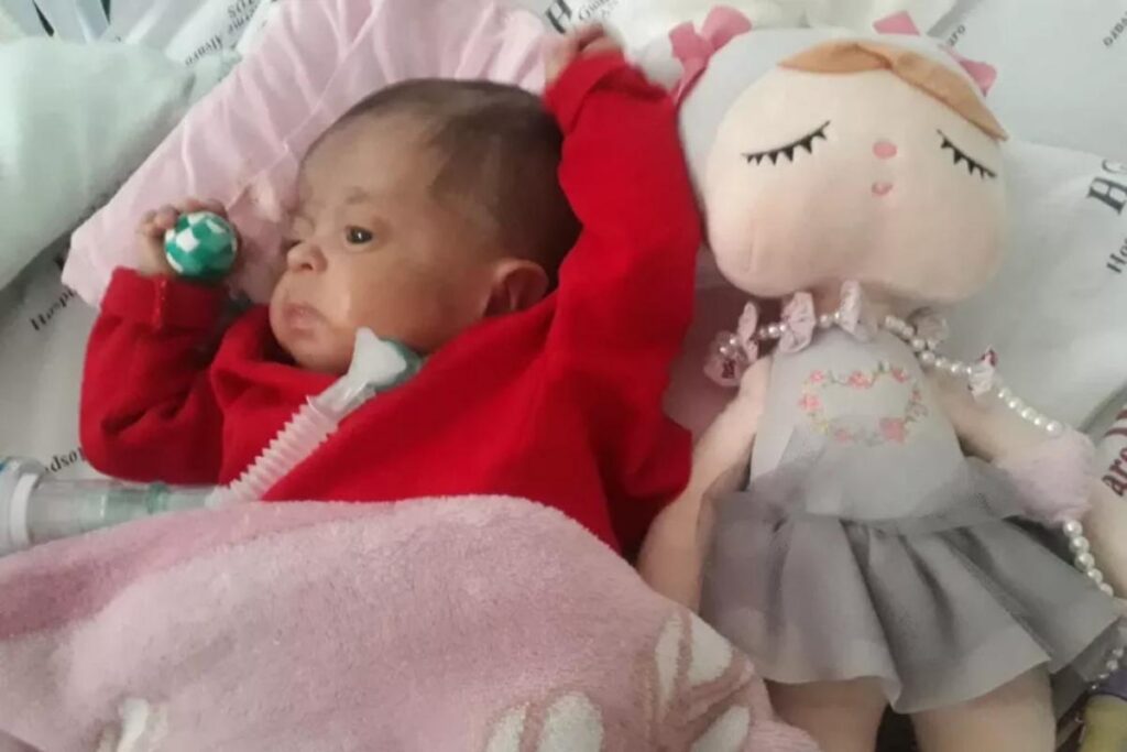 Mariana Mell Amaral Santos Demésio possui Síndrome de Edward e cardiopatia congênita