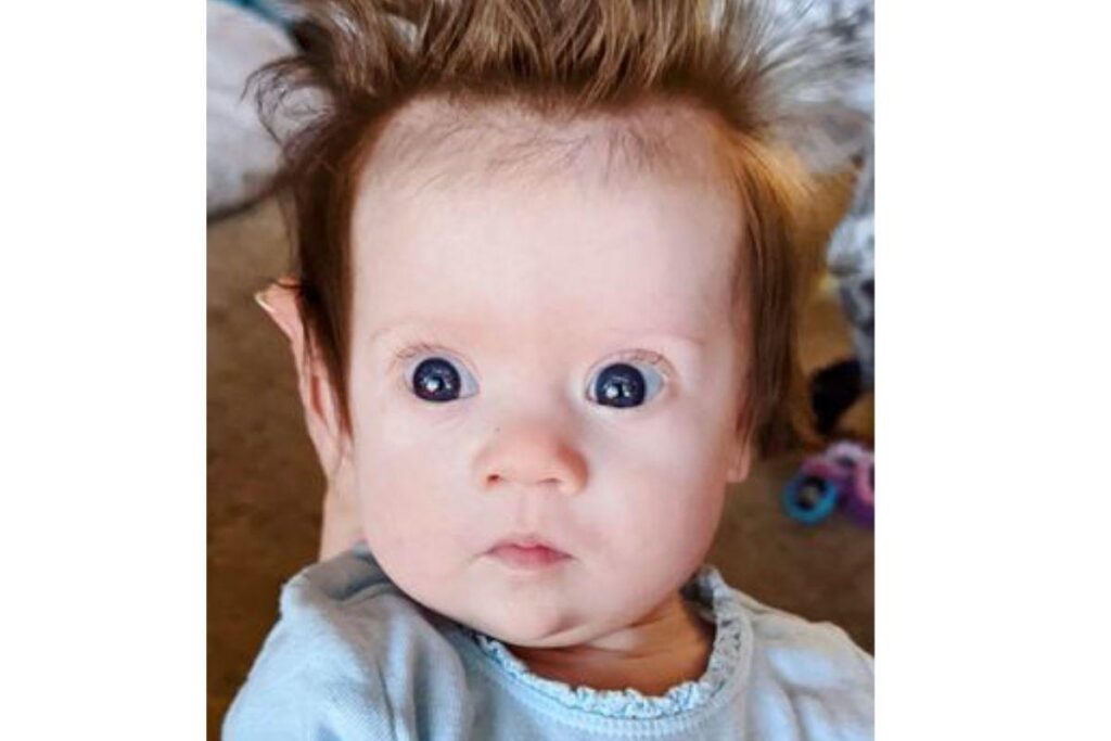 Menina de 4 meses chama atenção pelo tamanho do topete: “Parece o Jimmy Neutron”