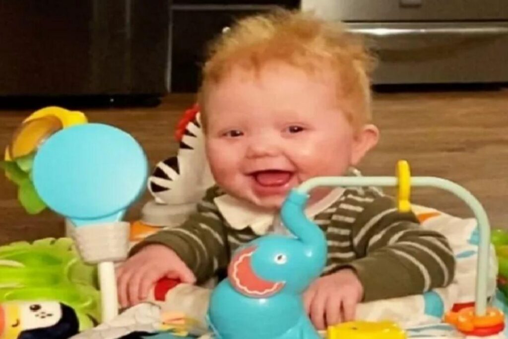 Bebê recebe transplante de timo