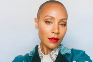 A alopecia provoca queda de cabelo e pode ter causas genéticas, de fundo emocional, por excesso de tração e até mesmo por problemas relacionados à alimentação