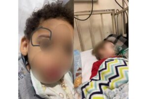 “Ela obrigou ele a comer até que vomitasse”: mãe relata abusos de creche que foi denunciada por maus-tratos