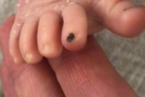 A mãe disse que pinta as unhas dos bebês para diferenciá-los