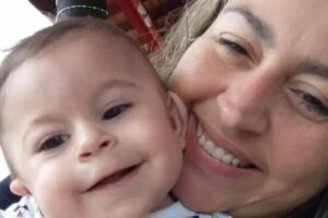 Bebê nasce com três braços em caso raro