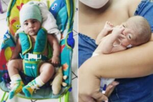 Bebê que nasceu com 600g aos 5 meses comemora 1 ano de vida em Fortaleza
