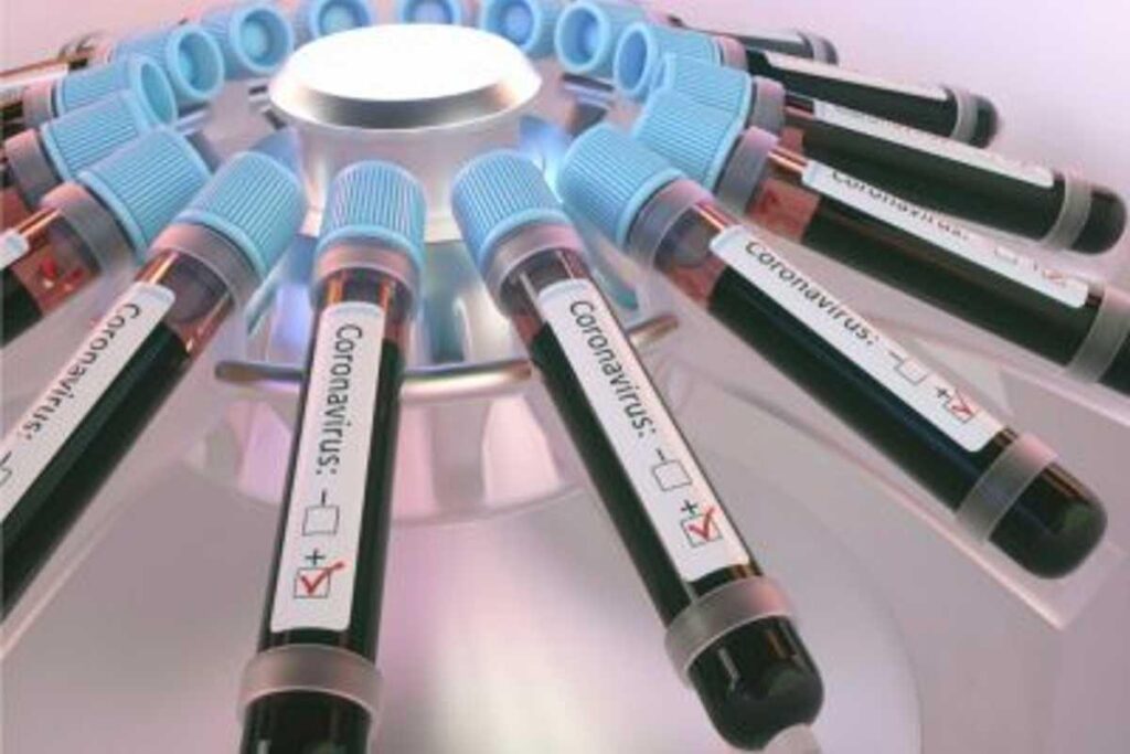 “Deltacron”: estudo preliminar identifica recombinação entre as variantes delta e ômicron