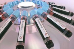 “Deltacron”: estudo preliminar identifica recombinação entre as variantes delta e ômicron