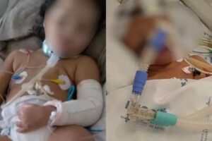 Justiça condenada padrasto e mãe deixarem criança de 3 anos em estado vegetativo