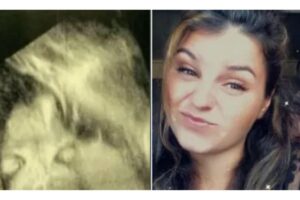 A mãe comparou a imagem da filha no ultrassom a um desenho