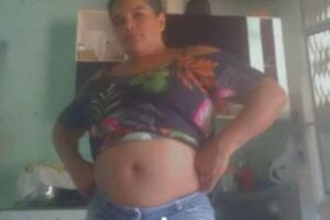 A mulher descobriu que estava grávida no oitavo mês de gestação, após sentir dores nas costas