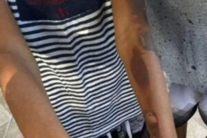 As crianças eram queimadas com colher quente pela mãe