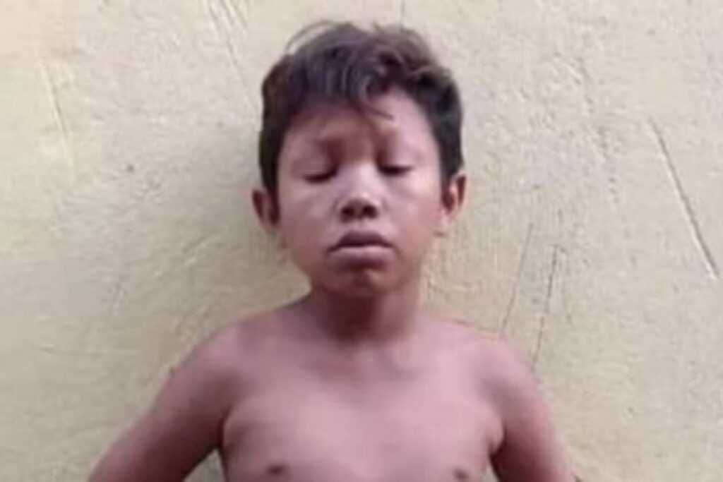 Homem de 20 anos com aparência de criança de 5 anos é morto a tiros no Pará