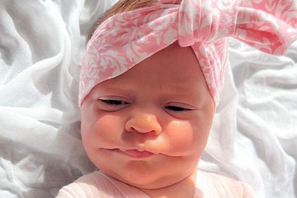 Ayla nasceu com macrostomia bilateral