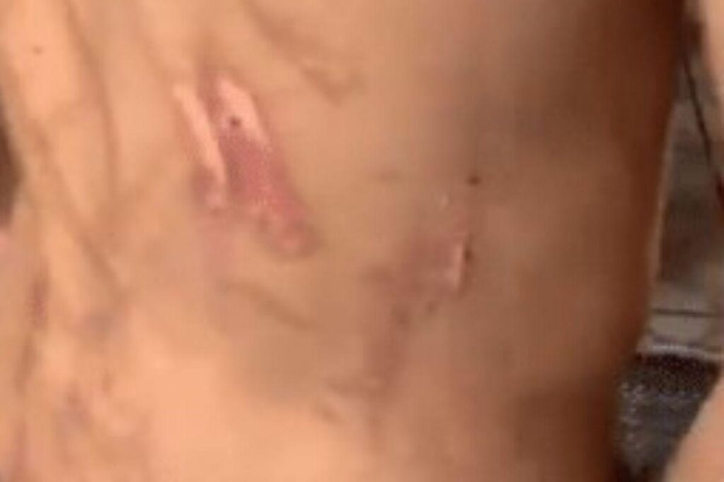 O menino sofria abusos físicos e psicológicos dos pais