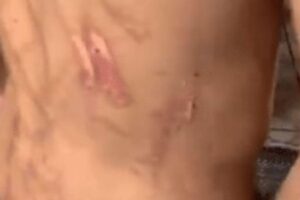 O menino sofria abusos físicos e psicológicos dos pais