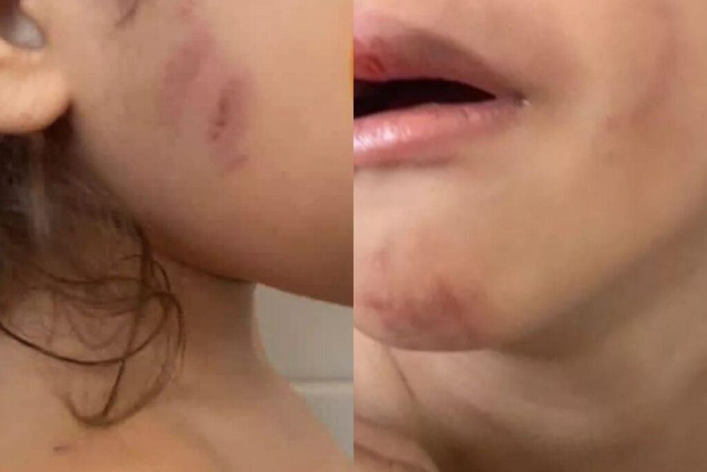 A criança sofreu um corte profundo na cabeça e tinha hematomas pelo corpo