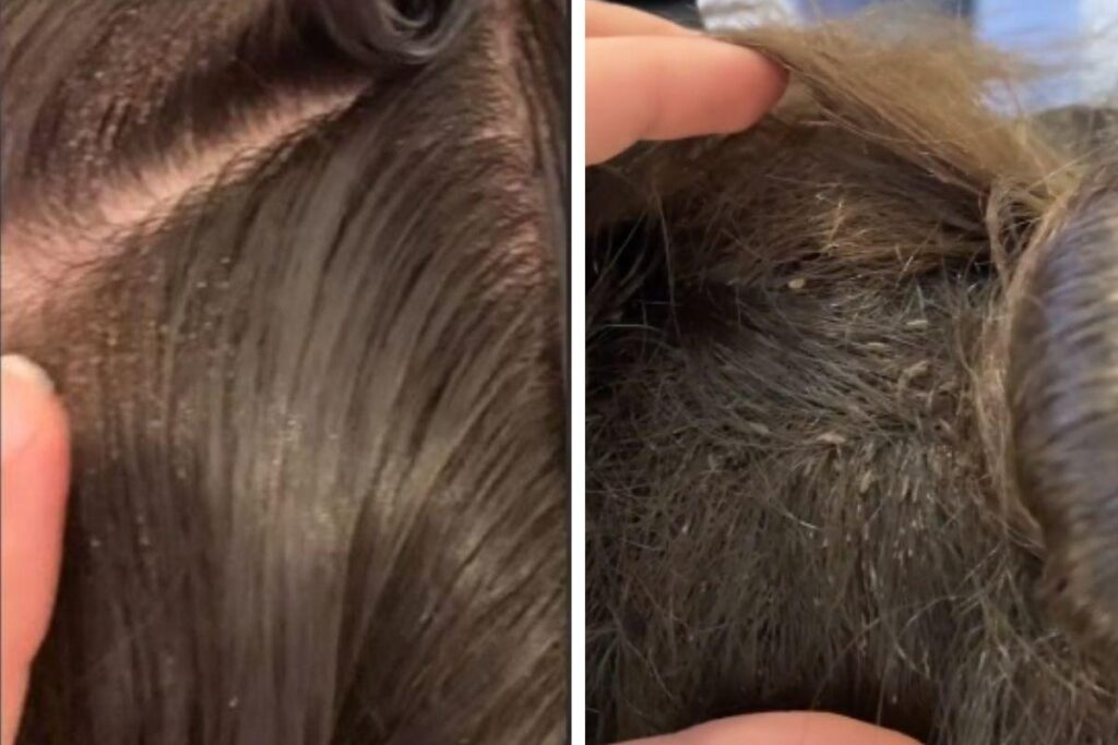 A cabeleireira sugeriu que os pais raspassem a cabeça da criança