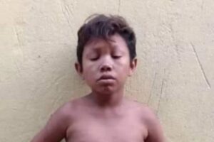 José é um homem de 20 anos com aparência de criança