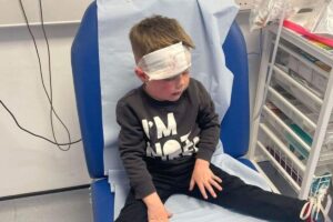 O menino ficou com machucados no rosto após ser atropelado por ciclista