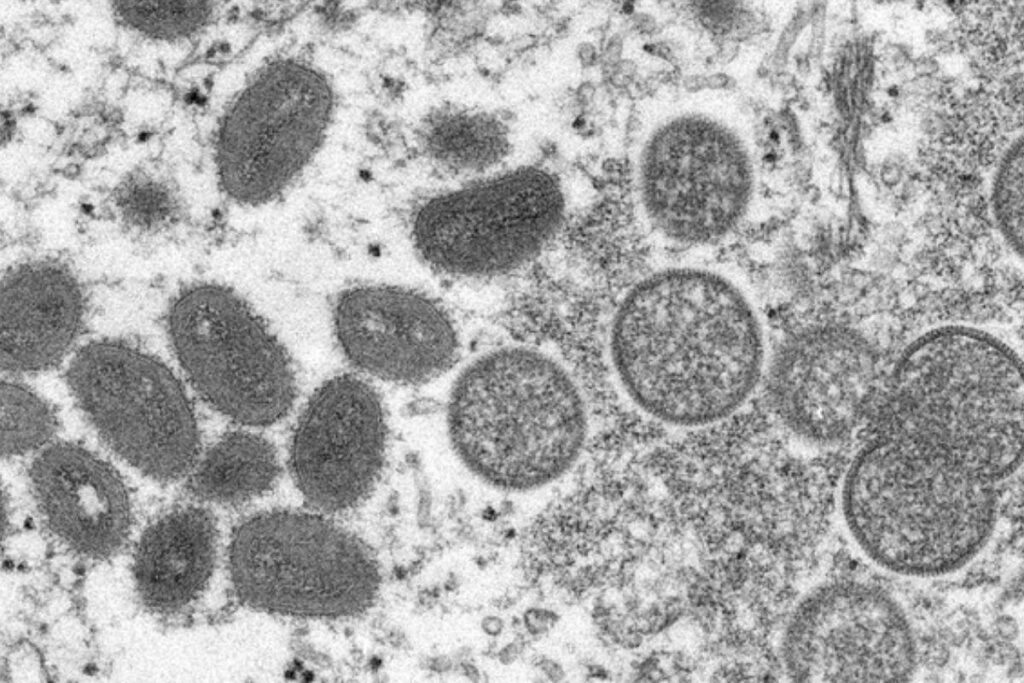 Uma das formas de transmissão da doença é por meio de gotículas que entram no sistema respiratório