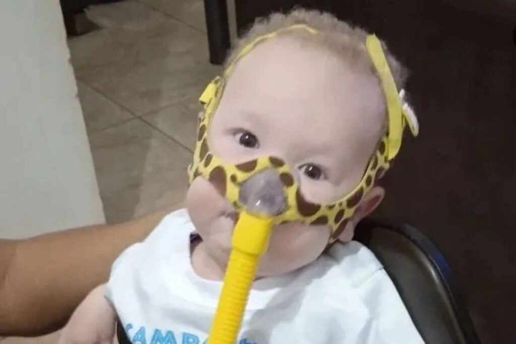 A AME é uma doença passada de pais para filhos