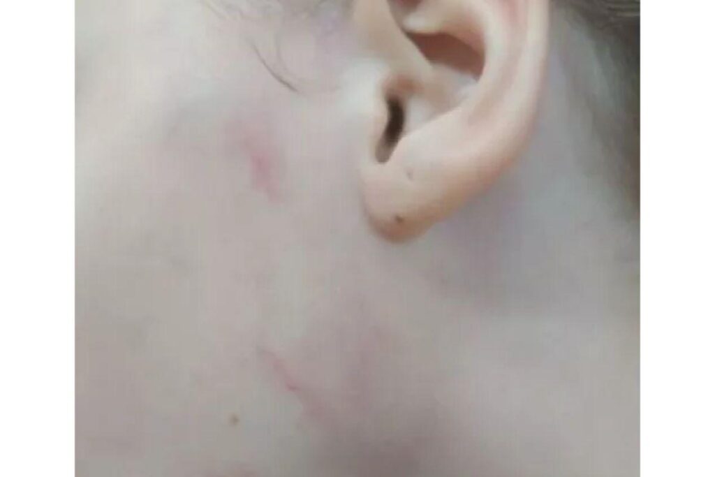 Uma vizinha da família denunciou os maus-tratos para as autoridades