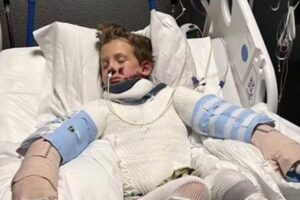 Barret estava realizando um experimento científico com álcool isopropílico e “ouro de tolo” quando o acidente aconteceu