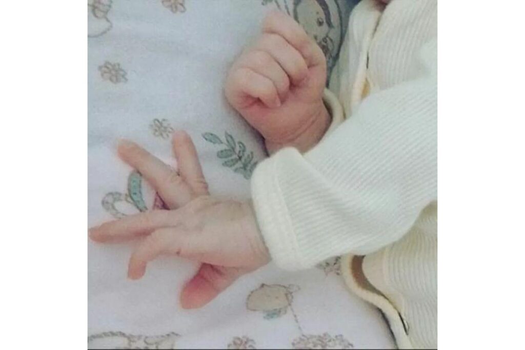 O bebê tinha fraturas no crânio, costelas quebradas e estava com os olhos roxos.