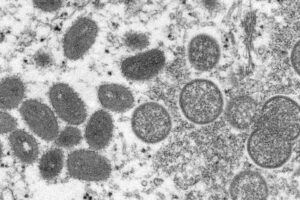 Segundo a OMS, as gestantes fazem parte do grupo de risco da monkeypox