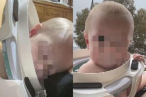 Registro realizado enquanto Wyatt estava com o assento sanitário preso em seu pescoço