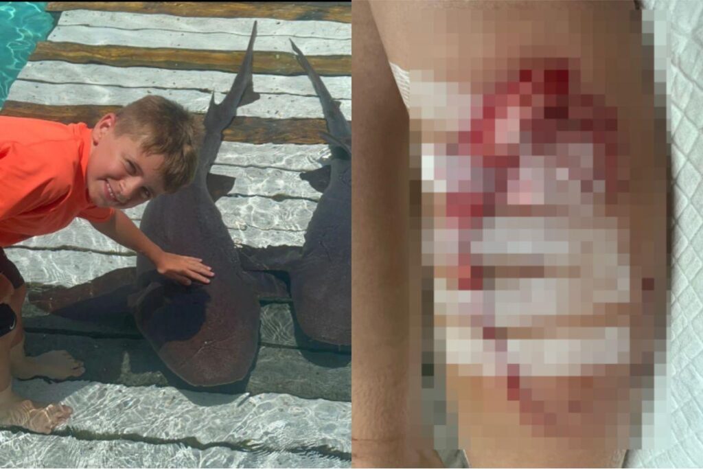 O menino estava passeando com os pais em uma excursão marítima quando o acidente aconteceu