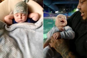 Pai faz tatuagem especial na cabeça em homenagem ao filho com hidrocefalia: “A luta dele é a minha”