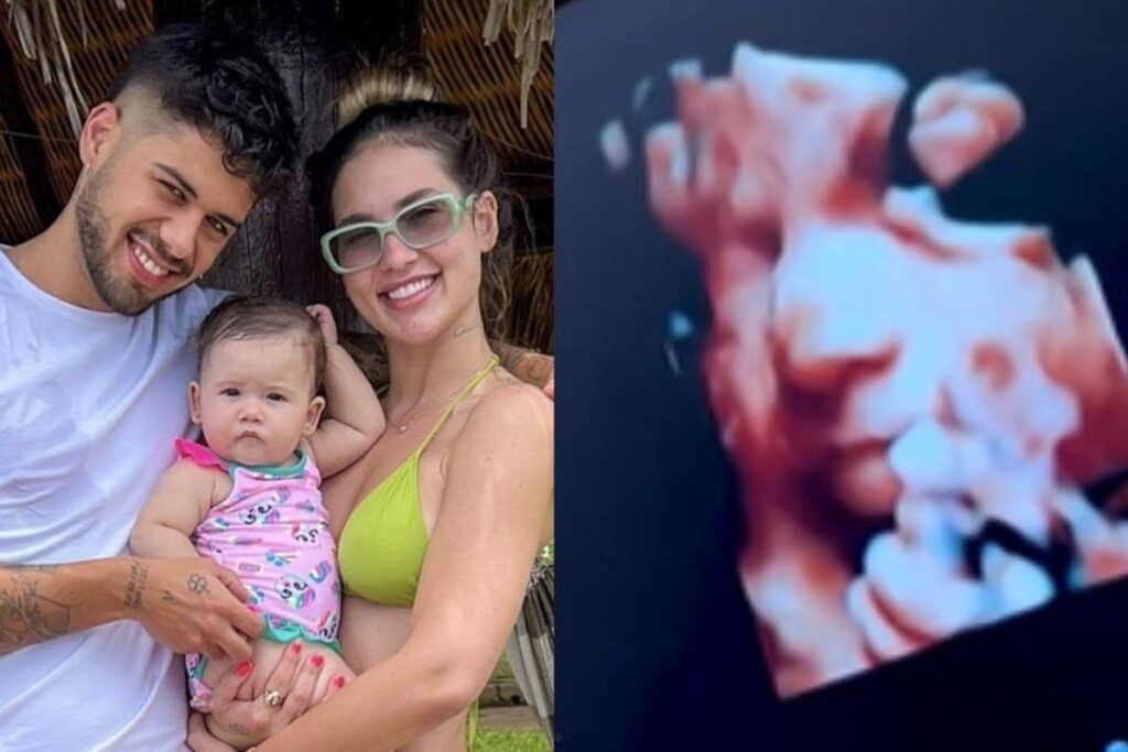 À esquerda, ultrassom de Maria Flor; à direita, ultrassom de Maria Alice